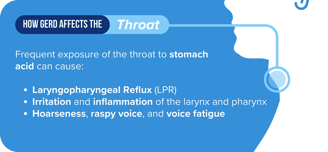 Infographic showing how GERD affects the throat and can cause laryngopharyngeal reflux, irritation of the larynx, and hoarseness.