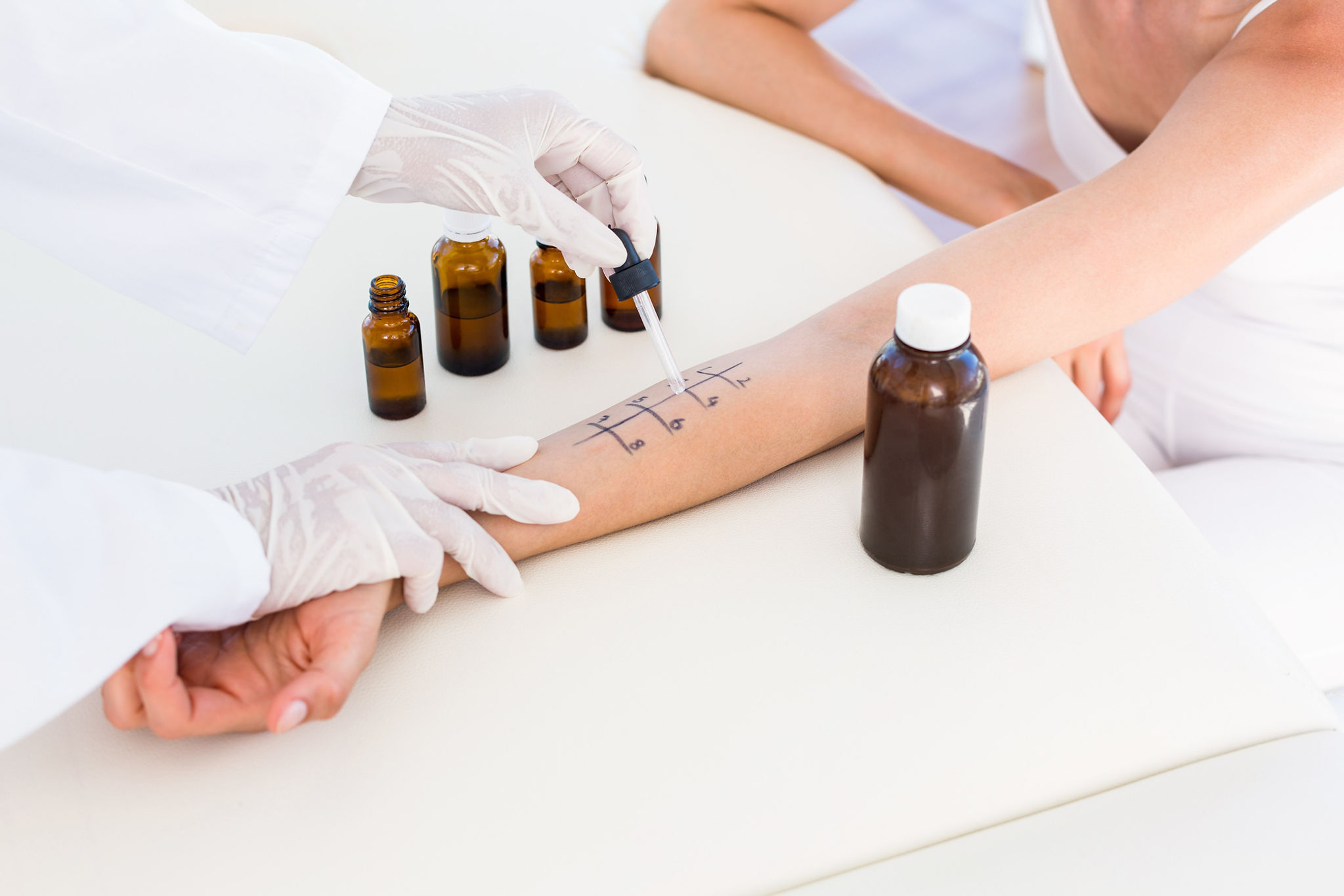 Minimally-invasive allergy testing using skin prick test.