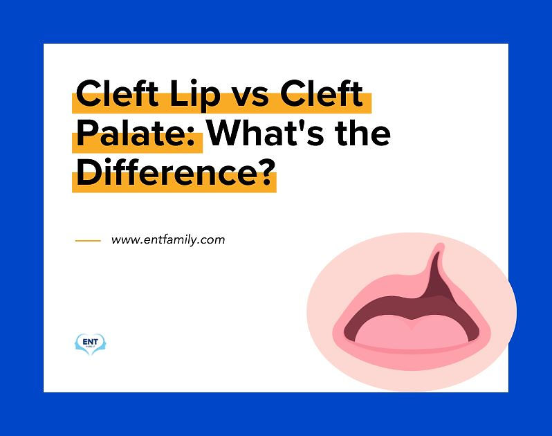 Cleft Lip & Cleft Palate: What's the Difference?