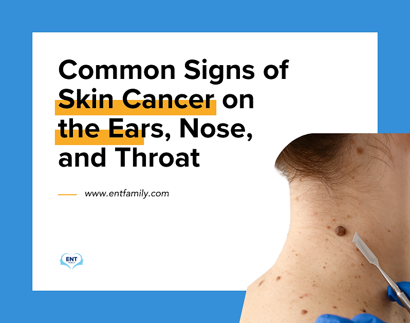 Common Signs of Skin Cancer on the Nose, Ears, and Throat